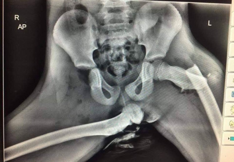 Piernas en el tablero
